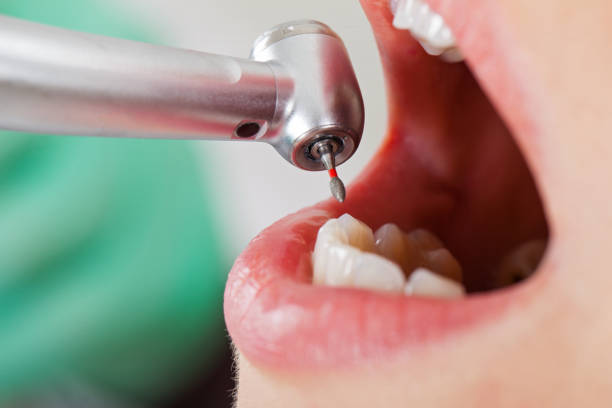 Emergency Gum Pain Relief in MN